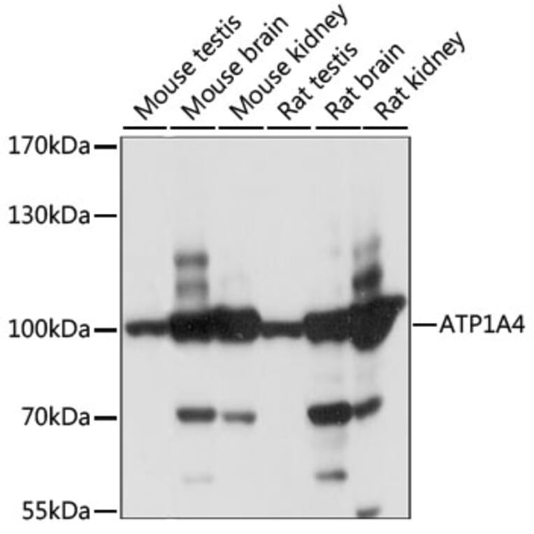 Western Blot - Anti-Sodium Potassium ATPase Antibody (A87701) - Antibodies.com