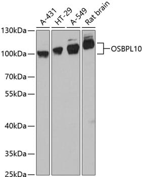 Western blot analysis of extracts of various cell lines, using Anti-OSBPL10 Antibody (A13199) at 1:3000 dilution.
Secondary antibody: Goat Anti-Rabbit IgG (H+L) (HRP) (AS014) at 1:10,000 dilution.
Lysates / proteins: 25µg per lane.
Blocking buffer: 3% non-fat dry milk in TBST.
Detection: ECL Basic Kit (RM00020).
Exposure time: 90s.