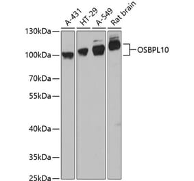 Western Blot - Anti-OSBPL10 Antibody (A87702) - Antibodies.com