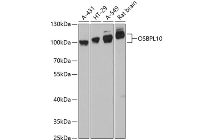 Western Blot - Anti-OSBPL10 Antibody (A87702) - Antibodies.com