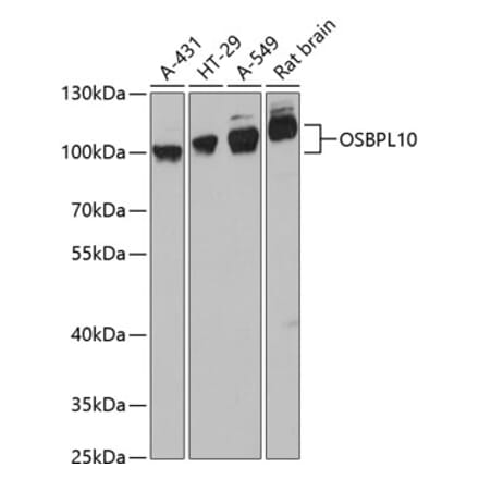 Western Blot - Anti-OSBPL10 Antibody (A87702) - Antibodies.com