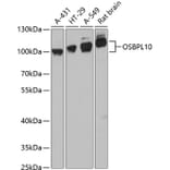 Western Blot - Anti-OSBPL10 Antibody (A87702) - Antibodies.com