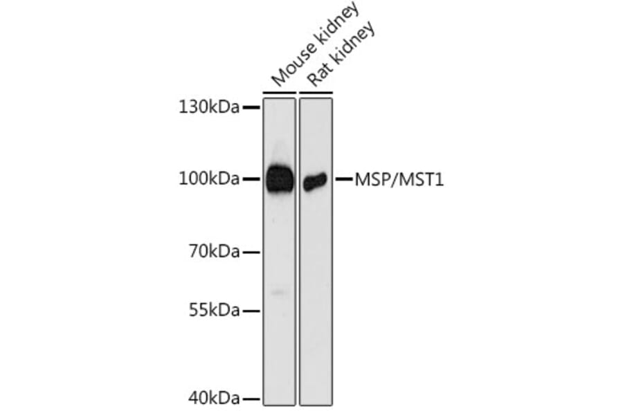 Western Blot - Anti-MSP/MST1 Antibody (A87703) - Antibodies.com