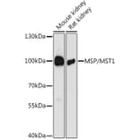 Western Blot - Anti-MSP/MST1 Antibody (A87703) - Antibodies.com