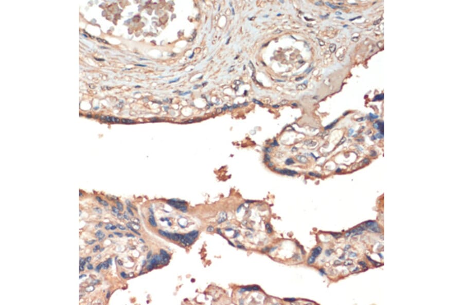 Immunohistochemistry - Anti-MSP/MST1 Antibody (A87703) - Antibodies.com