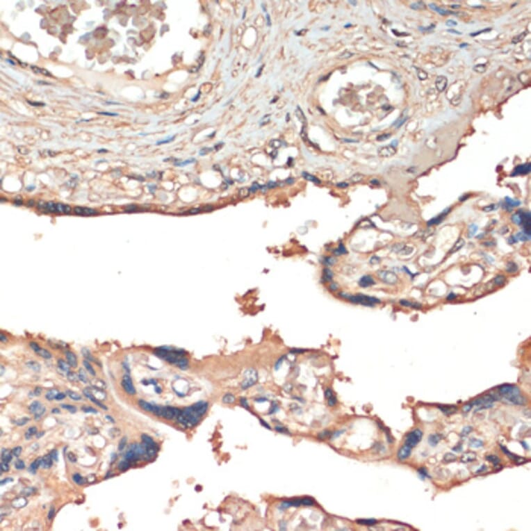 Immunohistochemistry - Anti-MSP/MST1 Antibody (A87703) - Antibodies.com