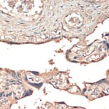 Immunohistochemistry - Anti-MSP/MST1 Antibody (A87703) - Antibodies.com