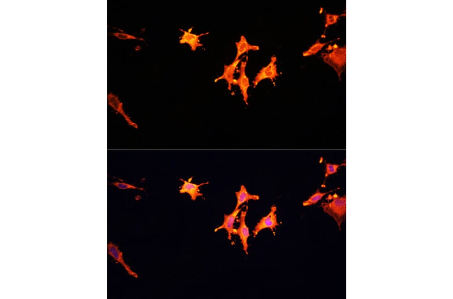 Immunofluorescence - Anti-MSP/MST1 Antibody (A87703) - Antibodies.com