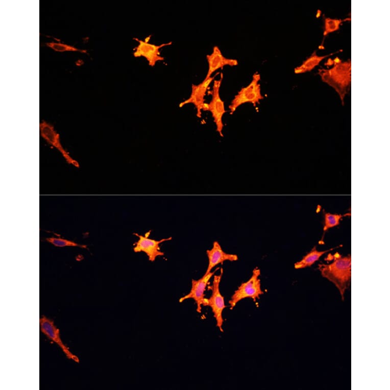 Immunofluorescence - Anti-MSP/MST1 Antibody (A87703) - Antibodies.com