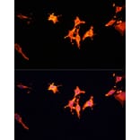 Immunofluorescence - Anti-MSP/MST1 Antibody (A87703) - Antibodies.com