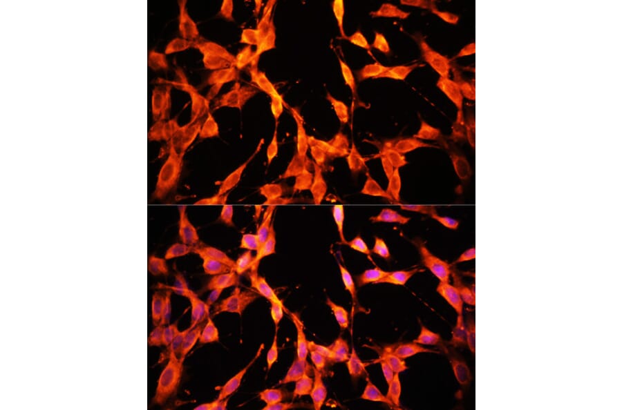 Immunofluorescence - Anti-MSP/MST1 Antibody (A87703) - Antibodies.com