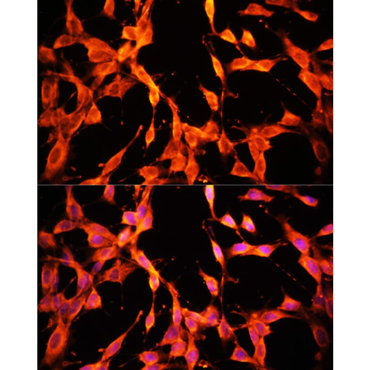 Immunofluorescence - Anti-MSP/MST1 Antibody (A87703) - Antibodies.com