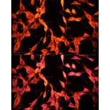 Immunofluorescence - Anti-MSP/MST1 Antibody (A87703) - Antibodies.com