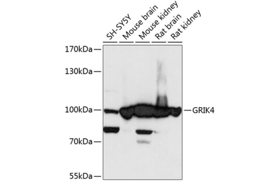 Western Blot - Anti-KA1 Antibody (A87704) - Antibodies.com