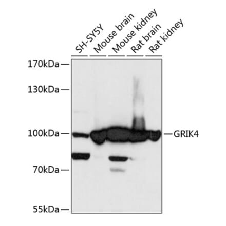 Western Blot - Anti-KA1 Antibody (A87704) - Antibodies.com