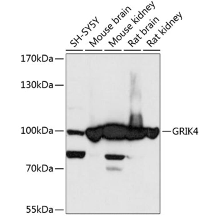 Western Blot - Anti-KA1 Antibody (A87704) - Antibodies.com