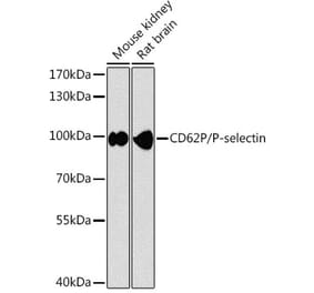 Western Blot - Anti-P-Selectin Antibody (A87705) - Antibodies.com