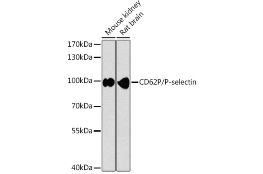 Western Blot - Anti-P-Selectin Antibody (A87705) - Antibodies.com
