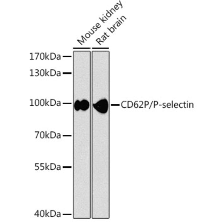 Western Blot - Anti-P-Selectin Antibody (A87705) - Antibodies.com