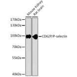 Western Blot - Anti-P-Selectin Antibody (A87705) - Antibodies.com