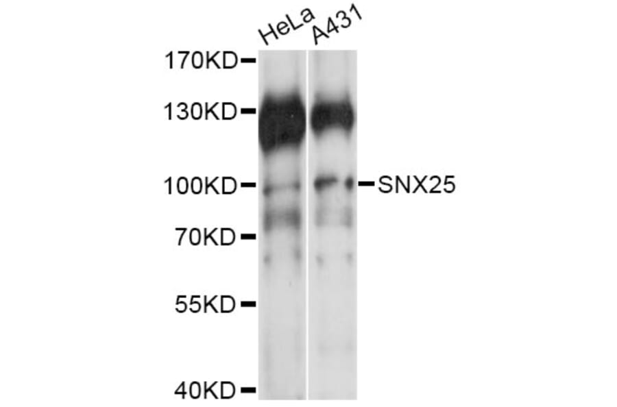 Western Blot - Anti-SNX25 Antibody (A14322) - Antibodies.com