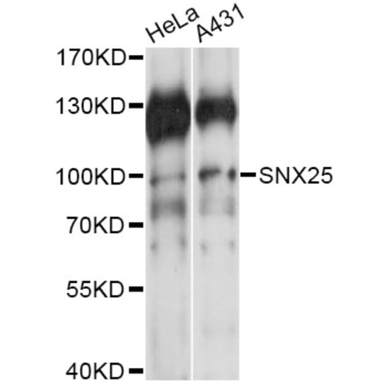 Western Blot - Anti-SNX25 Antibody (A14322) - Antibodies.com