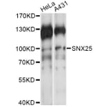 Western Blot - Anti-SNX25 Antibody (A14322) - Antibodies.com