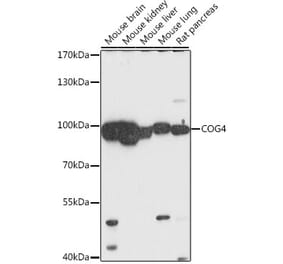 Western Blot - Anti-COG4 Antibody (A87707) - Antibodies.com