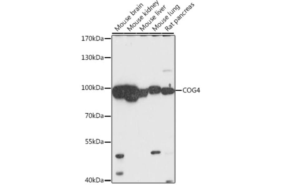 Western Blot - Anti-COG4 Antibody (A87707) - Antibodies.com