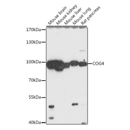 Western Blot - Anti-COG4 Antibody (A87707) - Antibodies.com