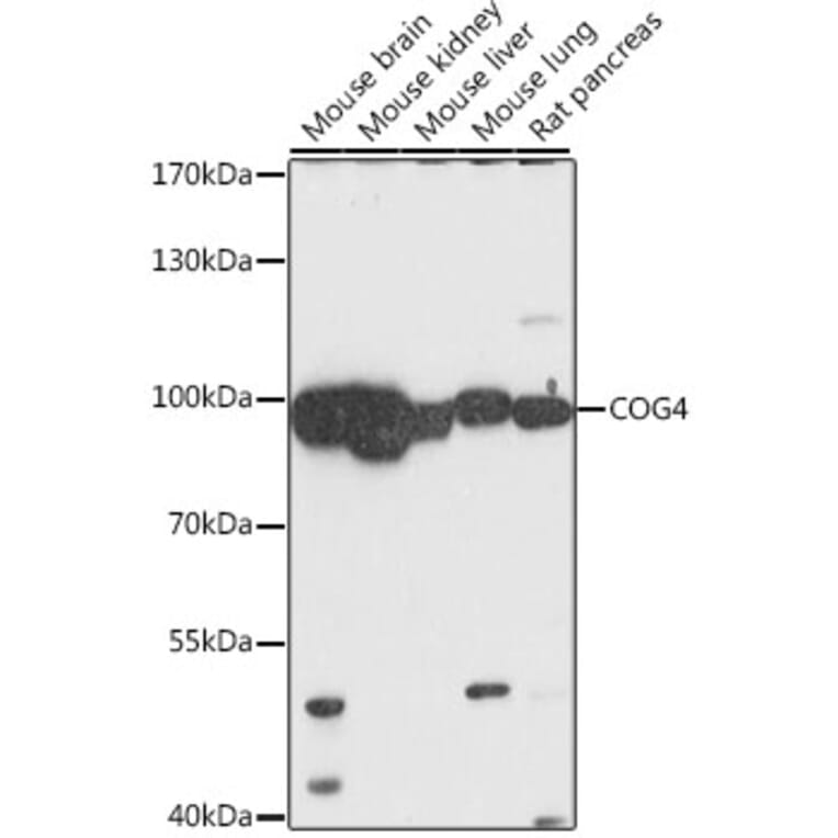 Western Blot - Anti-COG4 Antibody (A87707) - Antibodies.com