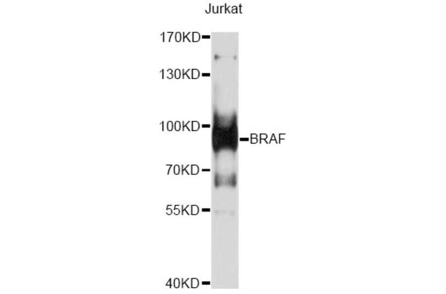 Western Blot - Anti-BRAF Antibody (A13953) - Antibodies.com