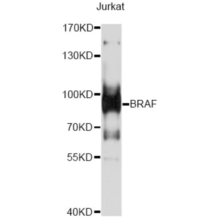 Western Blot - Anti-BRAF Antibody (A13953) - Antibodies.com