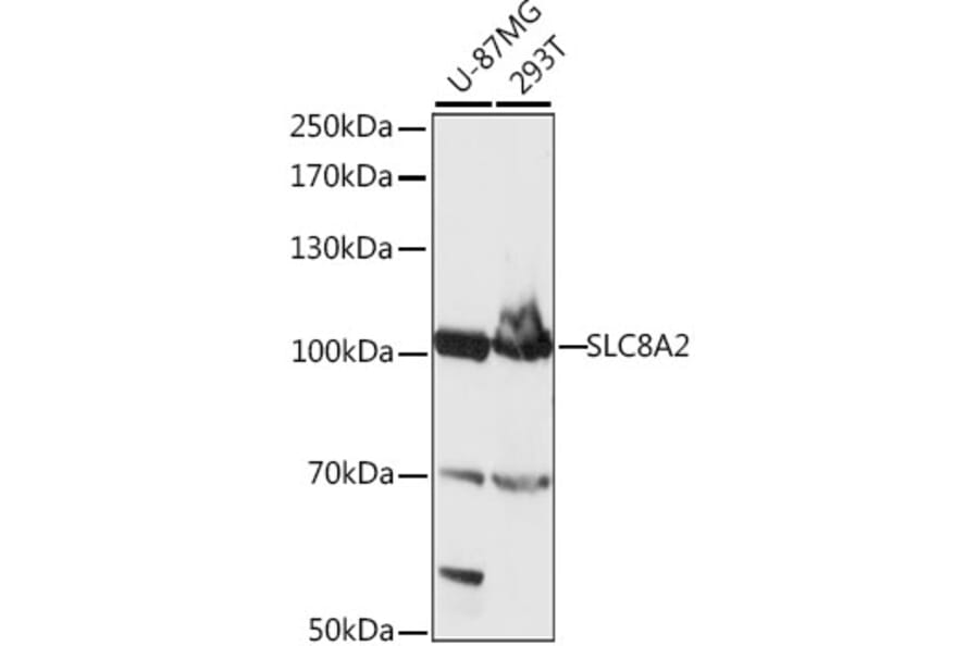 Western Blot - Anti-Sodium/calcium exchanger 2 Antibody (A87710) - Antibodies.com