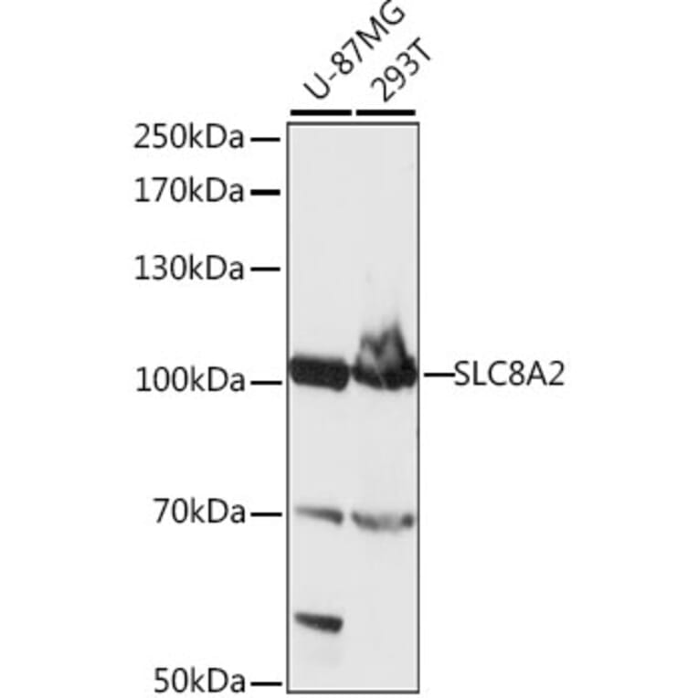 Western Blot - Anti-Sodium/calcium exchanger 2 Antibody (A87710) - Antibodies.com