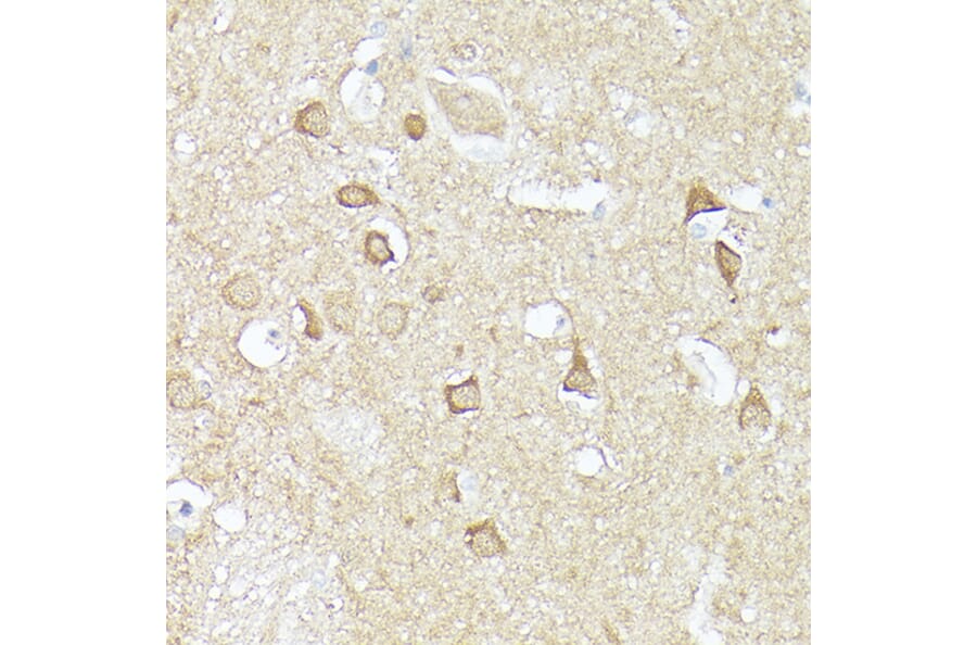 Immunohistochemistry - Anti-CX3CL1 Antibody (A87711) - Antibodies.com