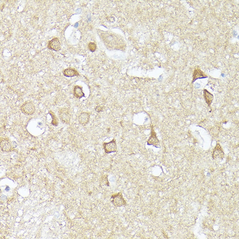 Immunohistochemistry - Anti-CX3CL1 Antibody (A87711) - Antibodies.com