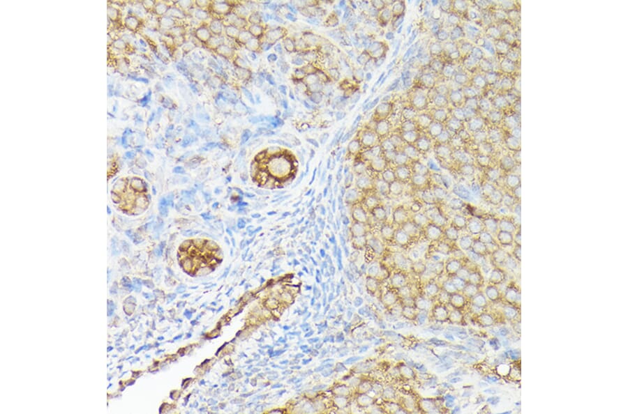 Immunohistochemistry - Anti-CX3CL1 Antibody (A87711) - Antibodies.com