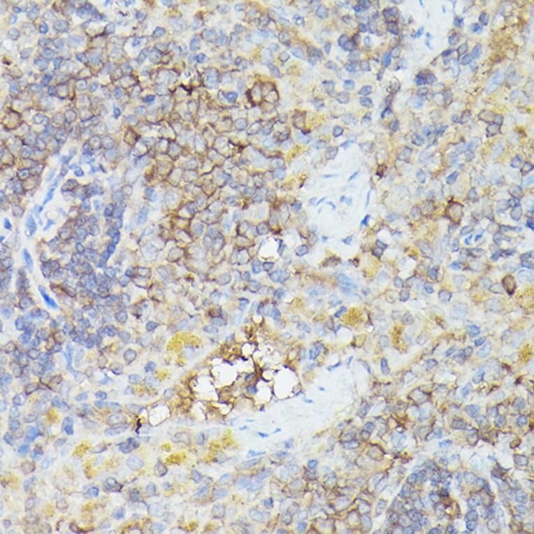 Immunohistochemistry - Anti-CX3CL1 Antibody (A87711) - Antibodies.com
