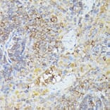 Immunohistochemistry - Anti-CX3CL1 Antibody (A87711) - Antibodies.com