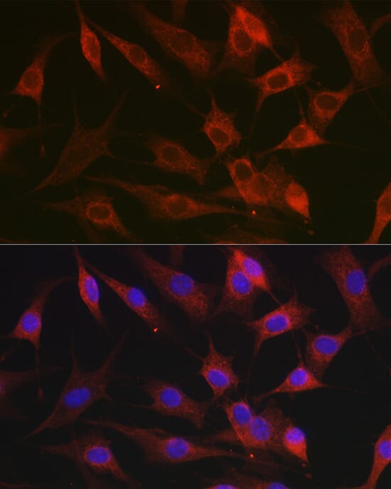 Anti-CX3CL1 Antibody (A87711) | Antibodies.com
