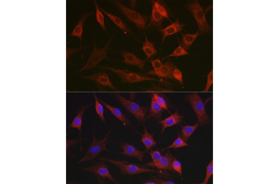 Immunofluorescence - Anti-CX3CL1 Antibody (A87711) - Antibodies.com