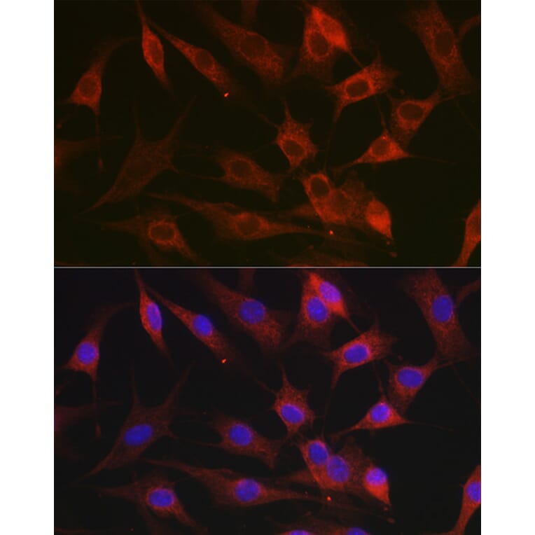 Immunofluorescence - Anti-CX3CL1 Antibody (A87711) - Antibodies.com