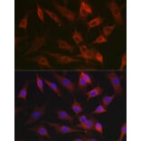 Immunofluorescence - Anti-CX3CL1 Antibody (A87711) - Antibodies.com