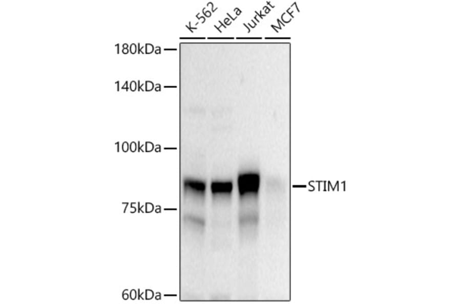 Western Blot - Anti-Stromal interaction molecule 1 Antibody (A87712) - Antibodies.com