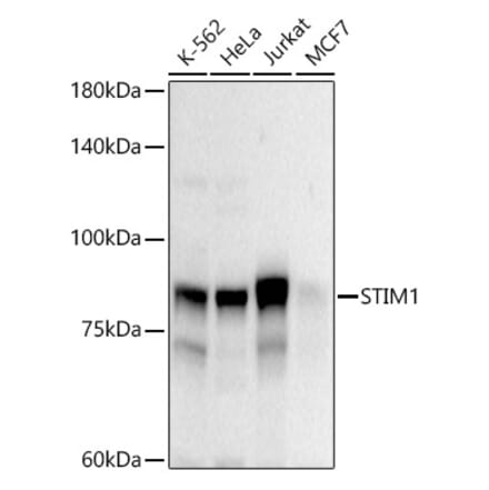 Western Blot - Anti-Stromal interaction molecule 1 Antibody (A87712) - Antibodies.com