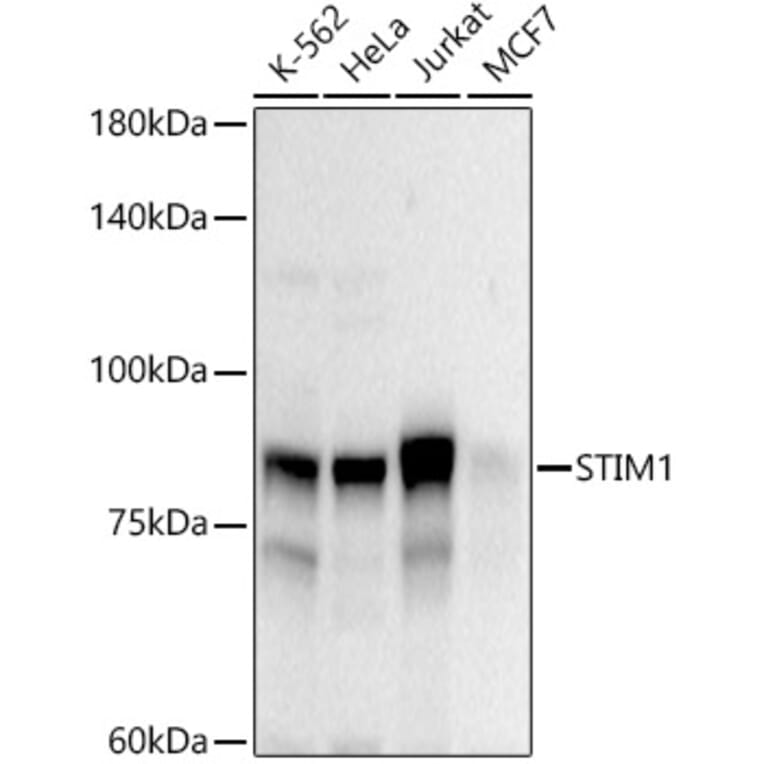 Western Blot - Anti-Stromal interaction molecule 1 Antibody (A87712) - Antibodies.com