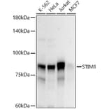 Western Blot - Anti-Stromal interaction molecule 1 Antibody (A87712) - Antibodies.com