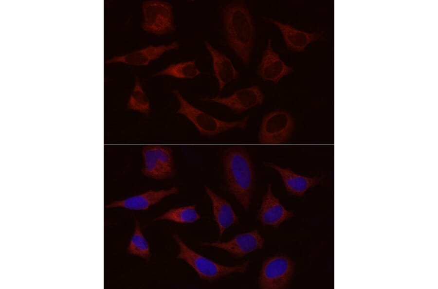 Immunofluorescence - Anti-Stromal interaction molecule 1 Antibody (A87712) - Antibodies.com