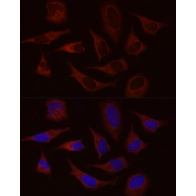 Immunofluorescence - Anti-Stromal interaction molecule 1 Antibody (A87712) - Antibodies.com